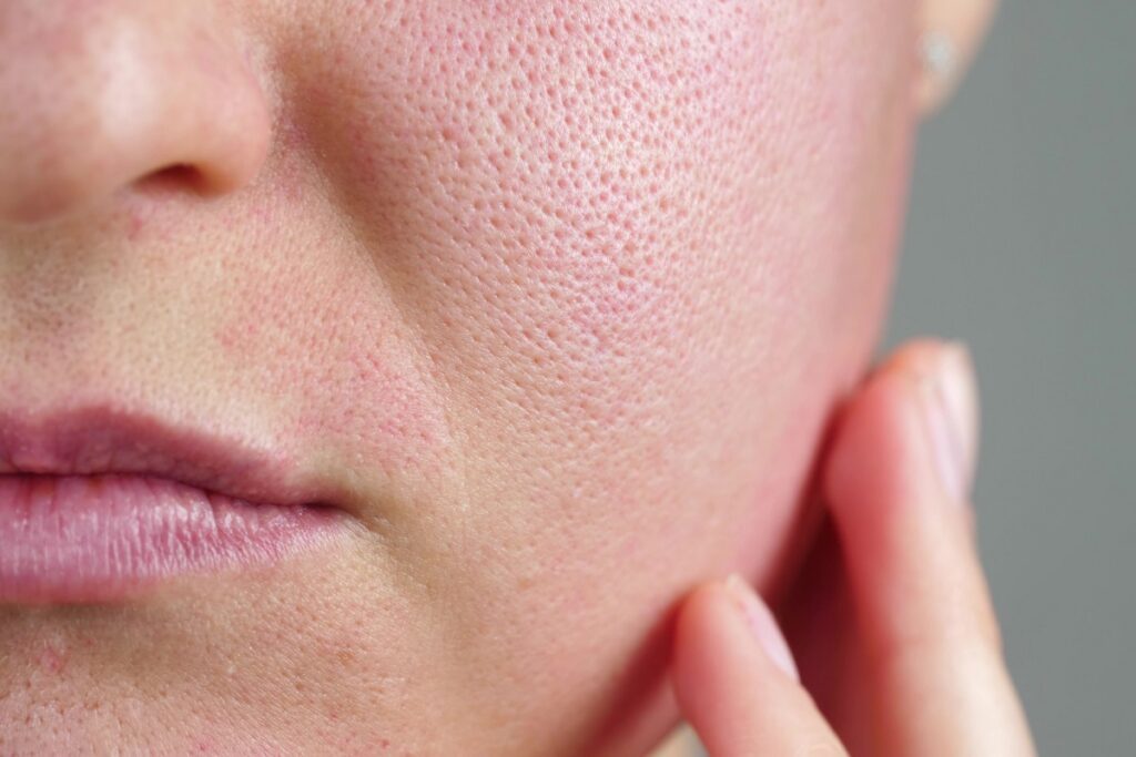 comment resserrer les pores du visage